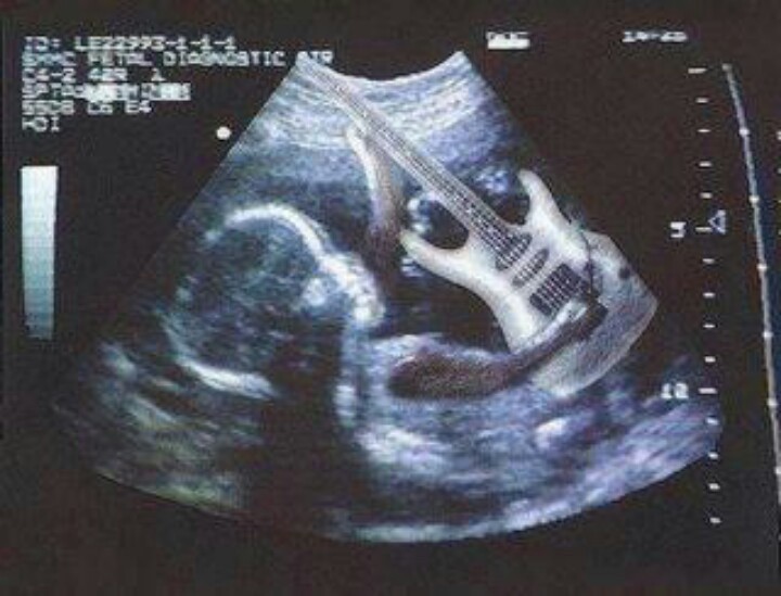 Radiografie cu un copil și o chitară electrică.